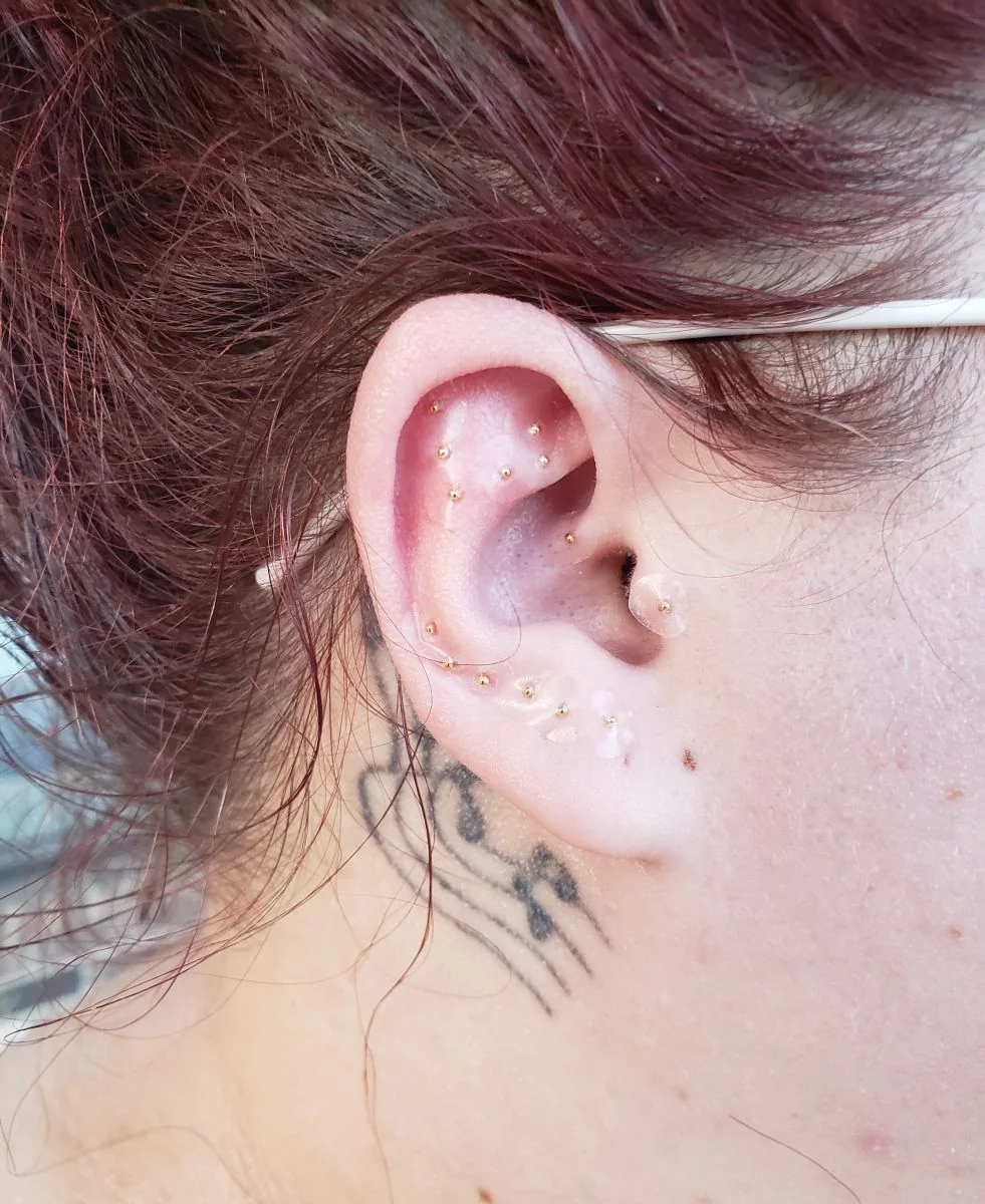 Gold ear seeds placed along the ear
